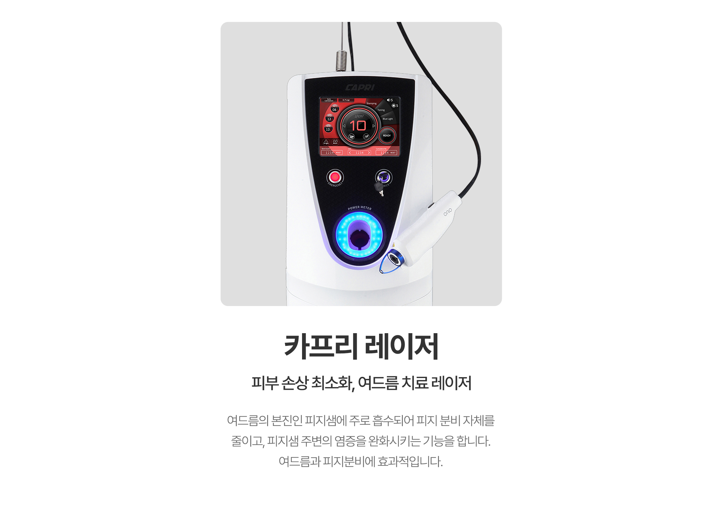 피부 손상 최소화, 여드름 치료 레이저. 카프리 레이저