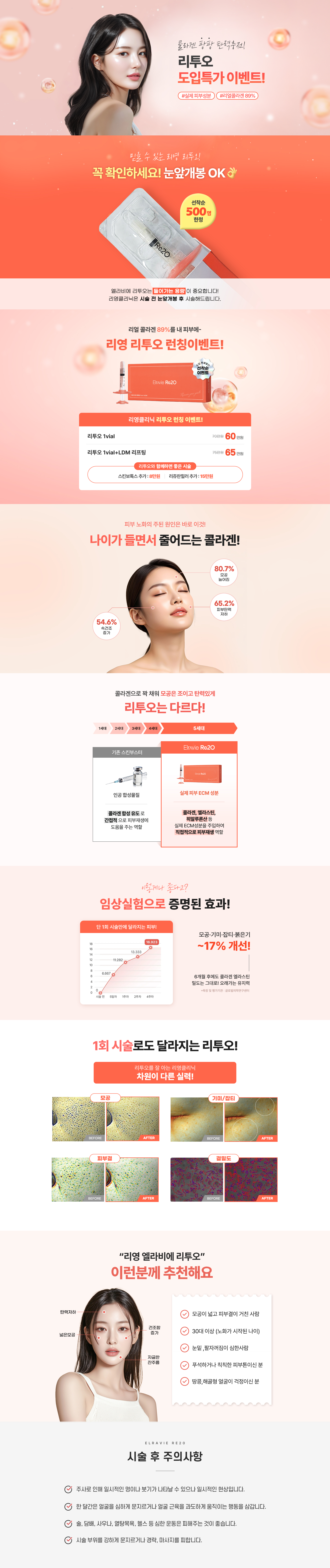 콜라겐 팡팡 탄력충전! 리투오 도입특가 이벤트! #실제 피부성분 #리얼콜라겐 89% - 믿을 수 있는 리영 리투오!